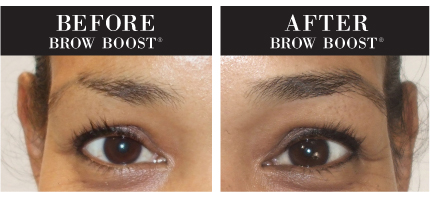 brow boost